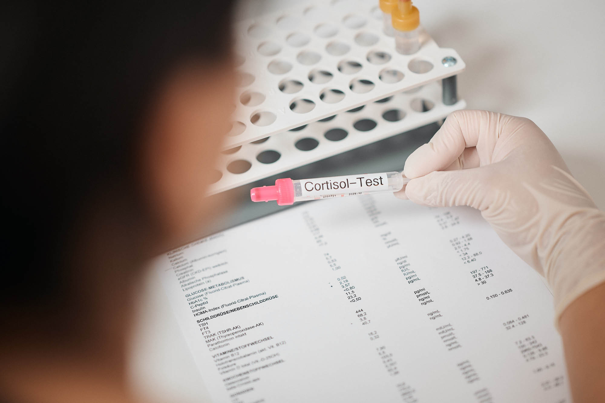 Das Teströhrchen eines Cortisol-Tests